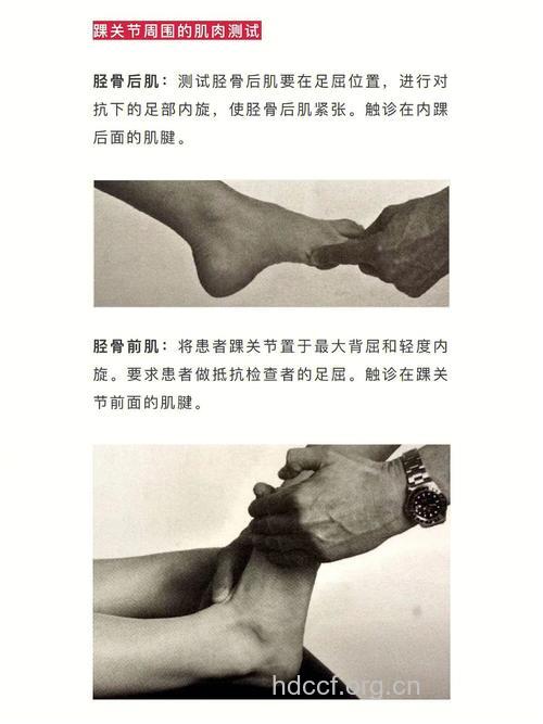 踝关节扭伤应该做哪些检查