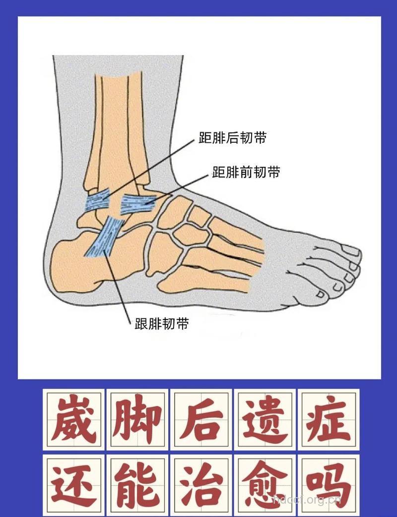 踝关节扭伤有哪些临床表现