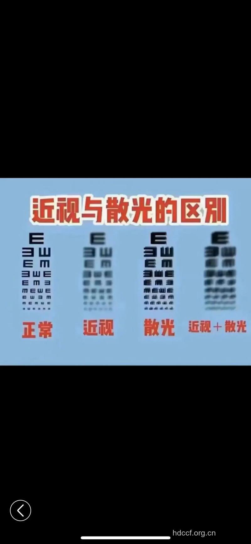 散光有什么症状表现