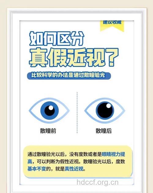 三种真假近视的鉴别方法