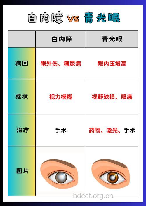 白内障患者症状类型及检查方法