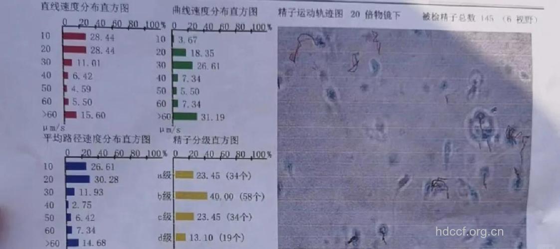 生育机会与精子运动速度成正比？