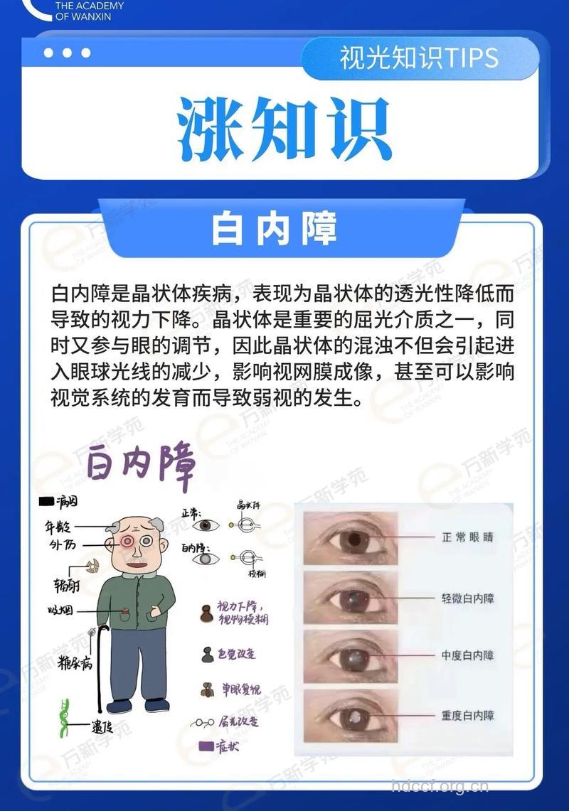 白内障患者的日常保健方法