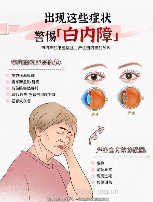 白内障早期症状及预防方法