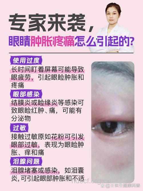 眼睛浮肿是什么原因
