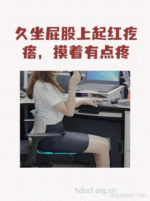 注意:长期久坐也会引起皮肤问题
