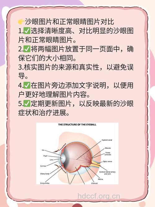 如何辨别是沙眼