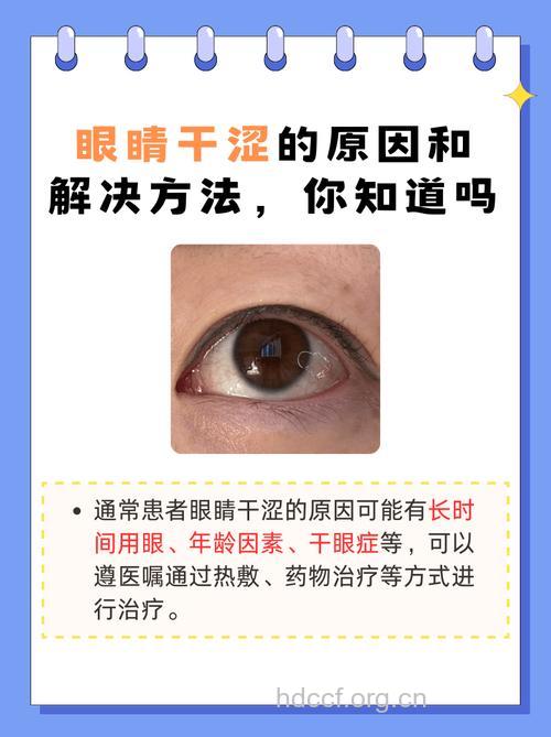 夏季常吹空调易导致干眼症