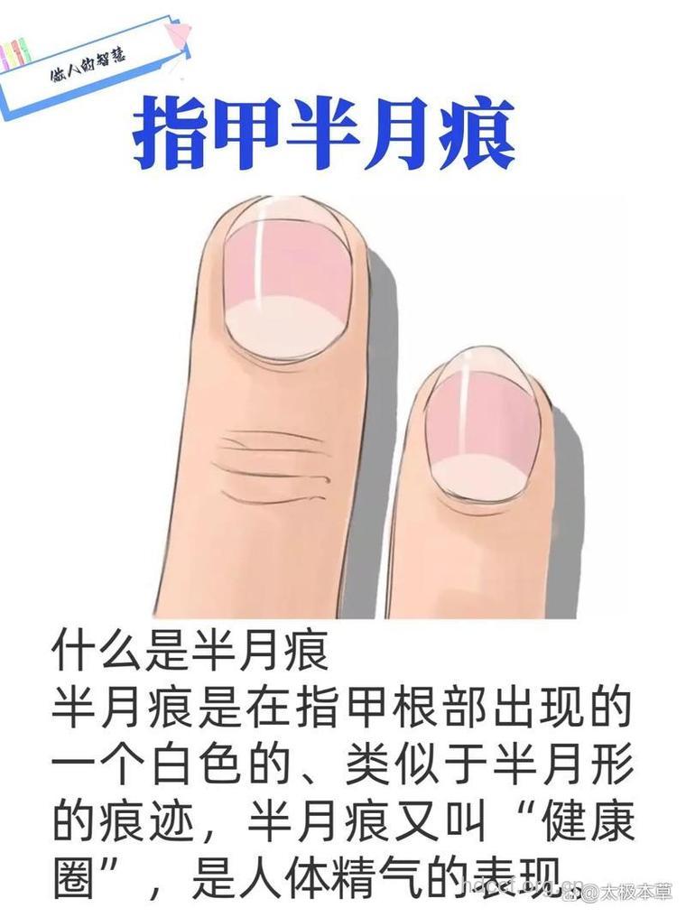 透过指甲“半月痕”看你的生育能力