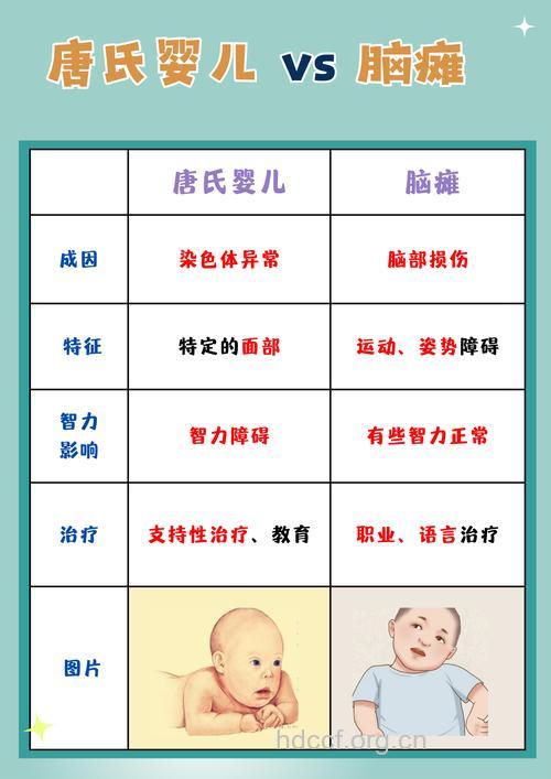唐氏综合症患儿分为哪些类型