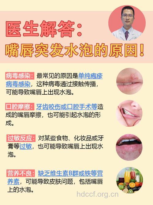 上火嘴巴起泡怎么办 中医教你这样处理