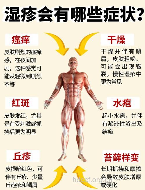 体内有湿气 皮肤会出现4个症状