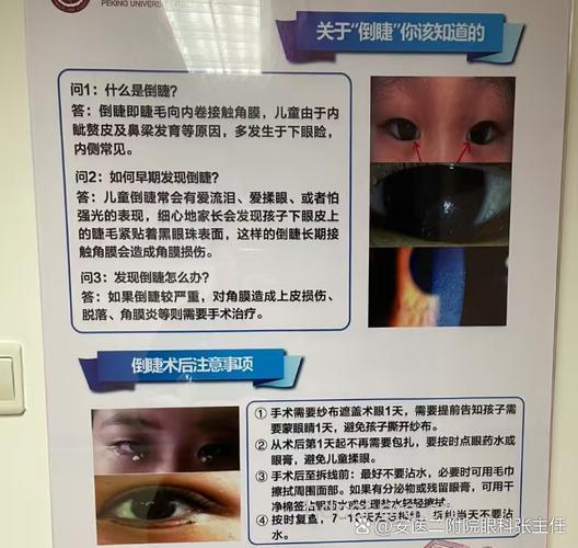 孩子倒睫什么时候手术好