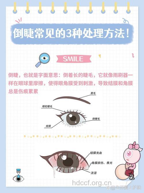 成年人倒睫的3种治疗方法