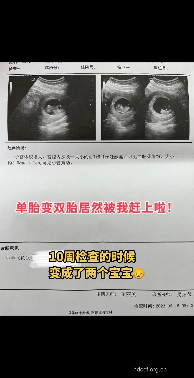 为何双胞胎却变成了单胎