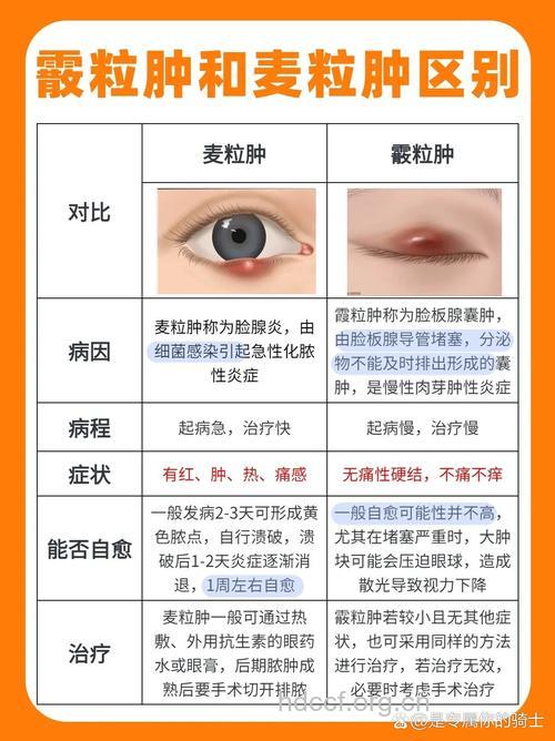 白粒肿眼睛肿痛治疗偏方