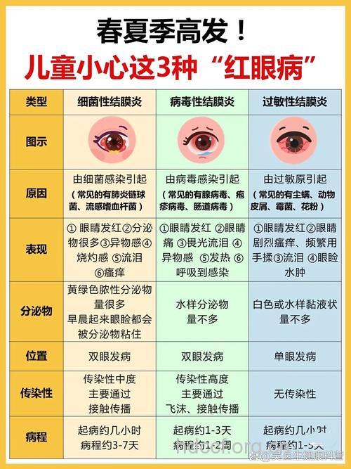 红眼病简介 红眼病的症状治疗