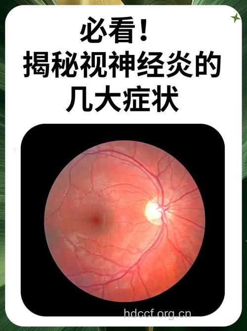 视神经炎有什么症状