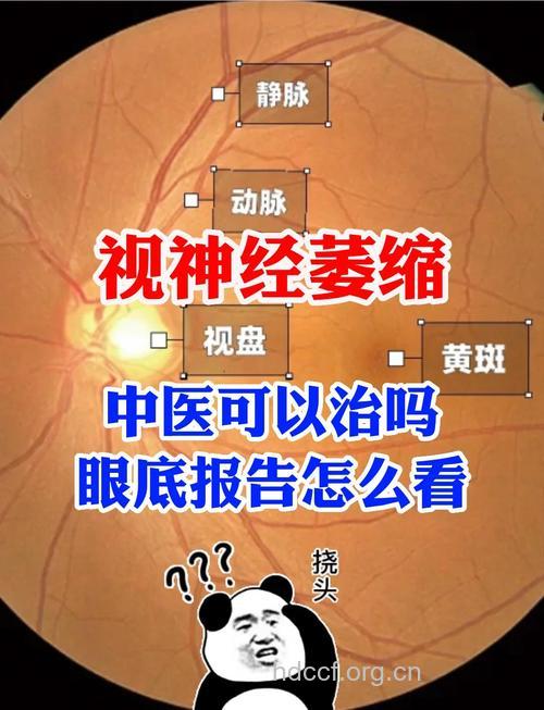 为什么会视神经萎缩