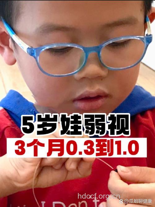 非母乳喂养婴儿弱视多
