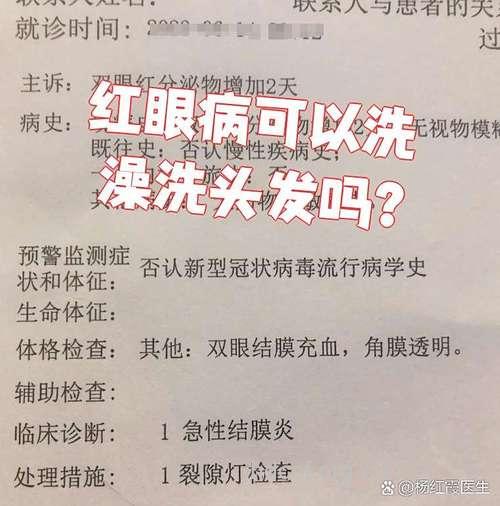 感染红眼病能不能洗头