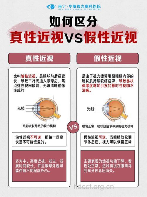 辨别儿童真假性近视的两个方法