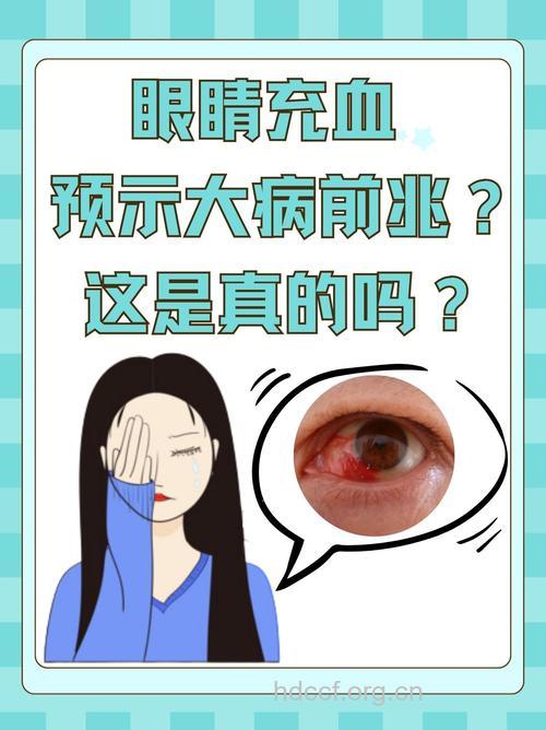 红眼病会影响视力吗