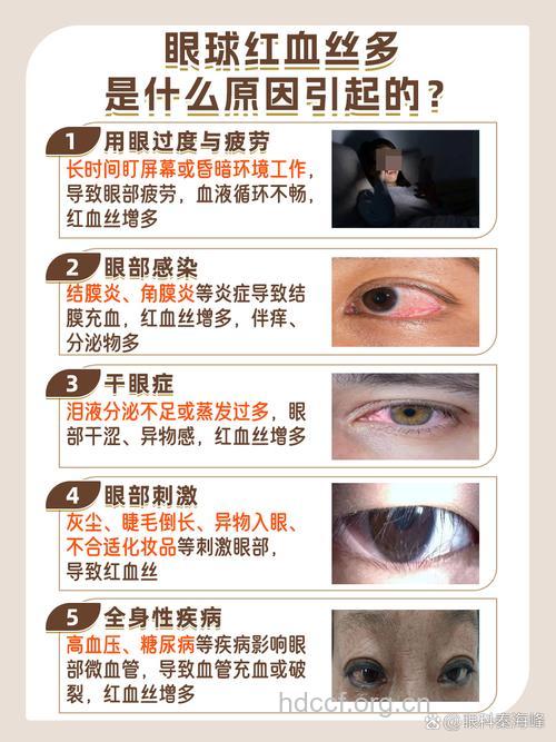 如何诊断红眼病