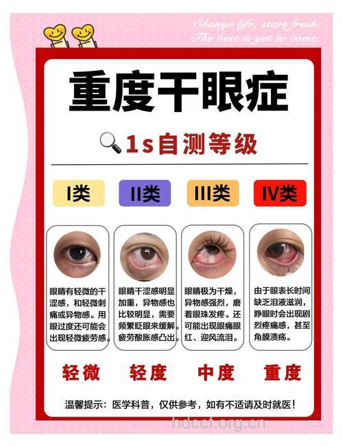 干眼症的3大类型
