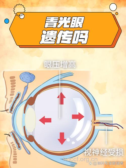 青光眼遗传有多种方式