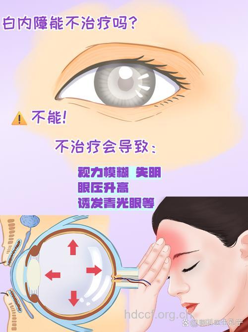 视线变模糊警惕是白内障