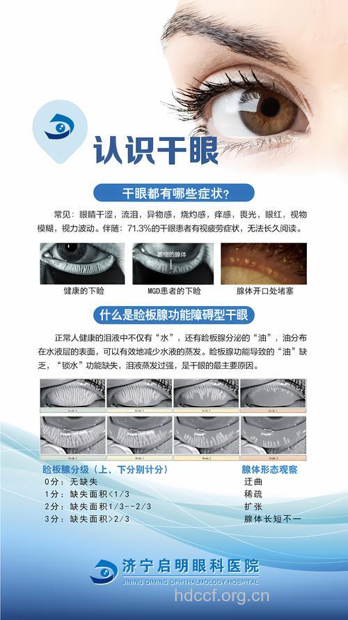 白内障手术后干眼是怎么回事