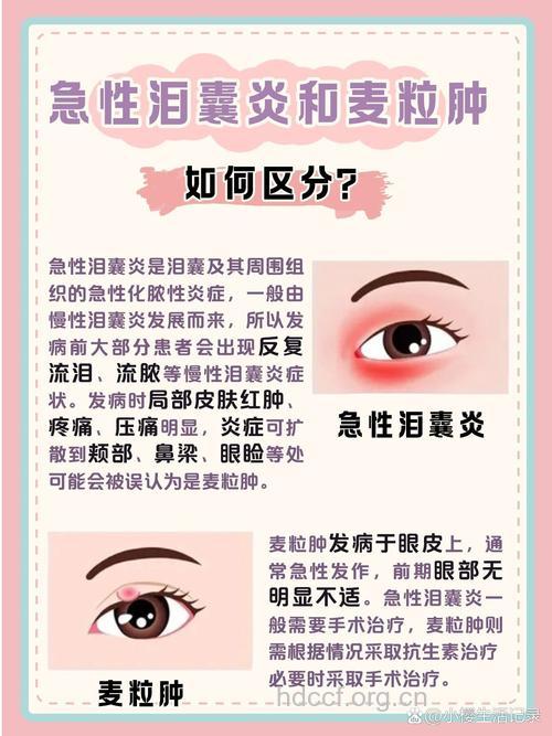 麦粒肿和急性泪囊炎的区别有哪些