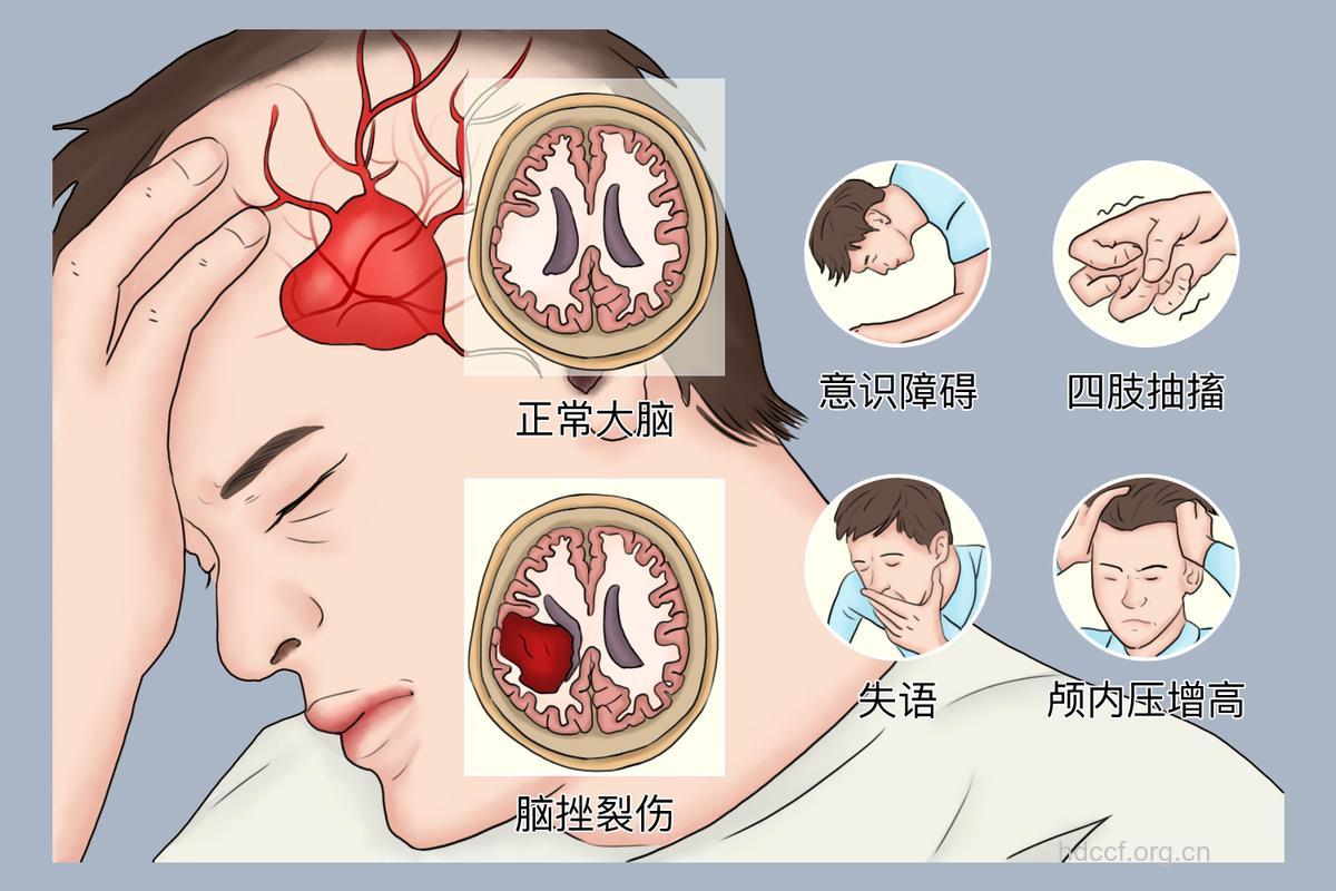 大脑损伤后的心理障碍