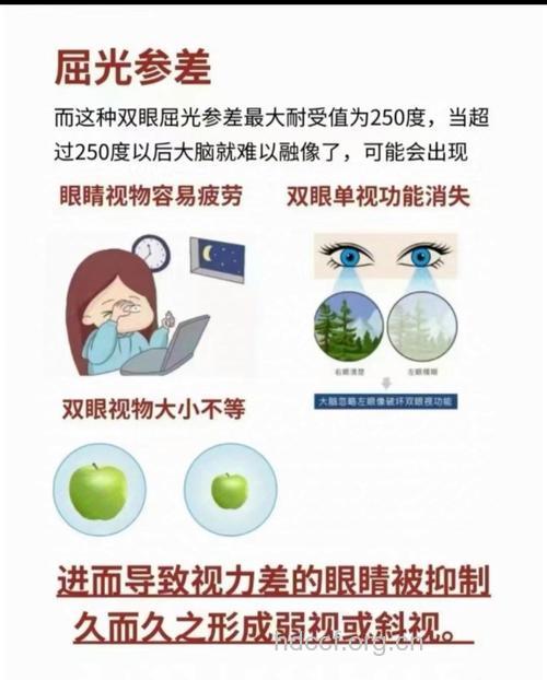 屈光参差性弱视治疗护理