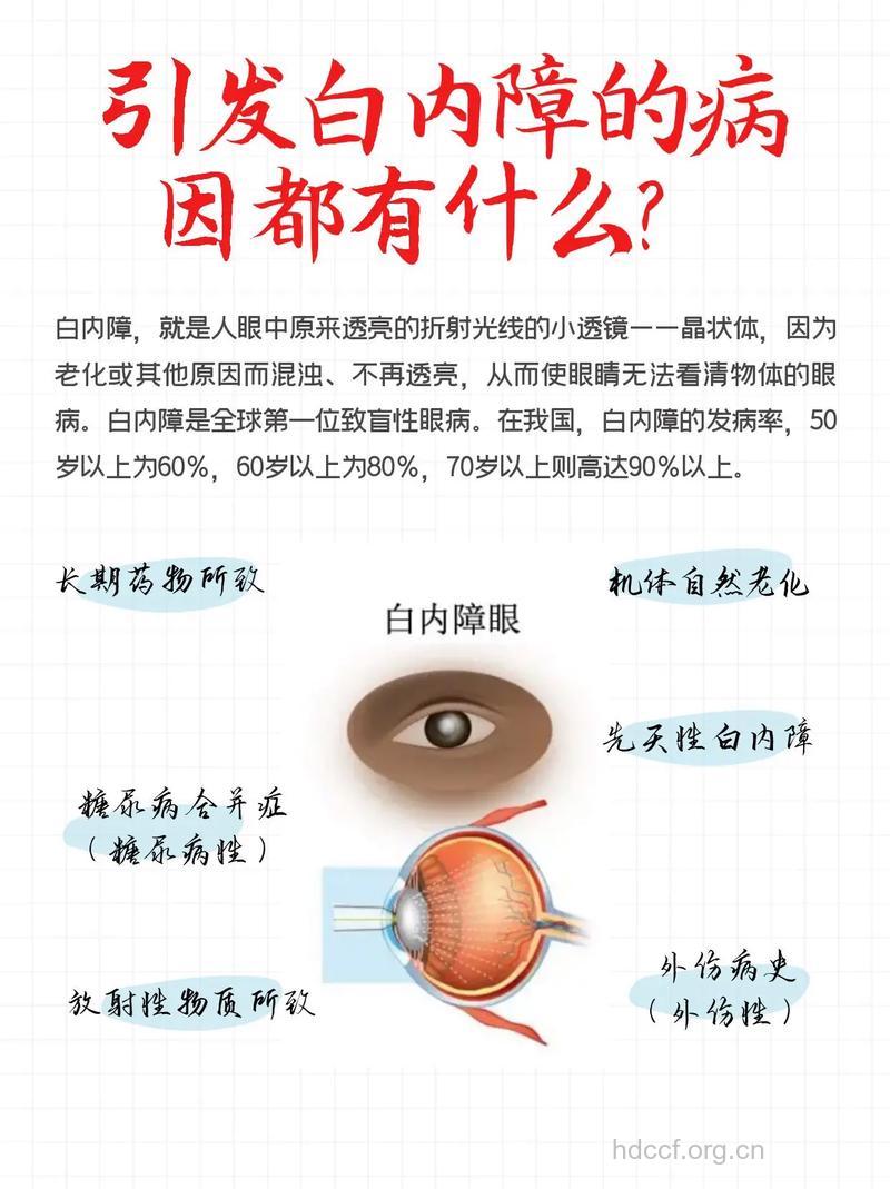 白内障的病因和防治方法