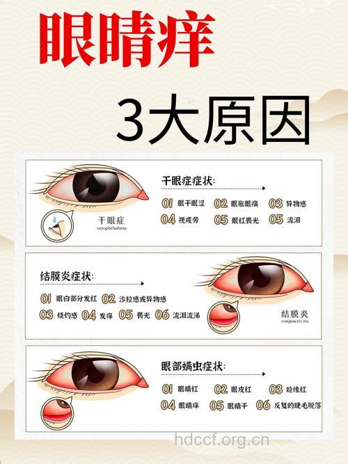 眼睛干涩还痒是怎么回事
