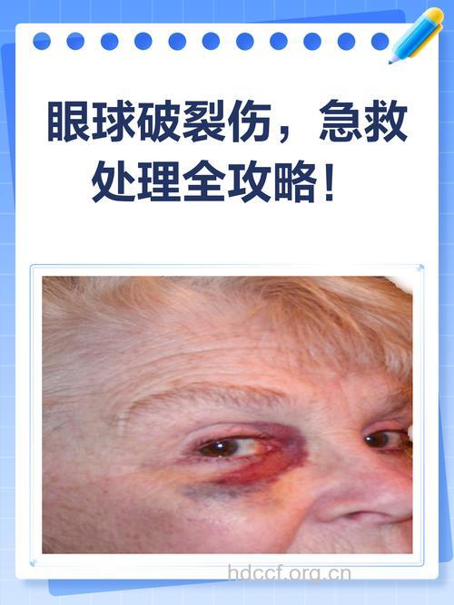 眼球穿通伤症状诊断
