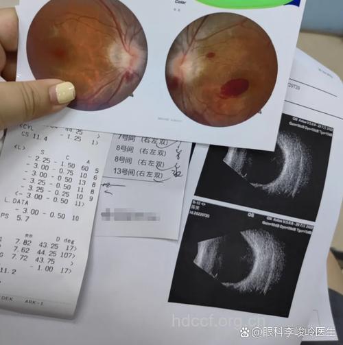 眼外伤的一般检查
