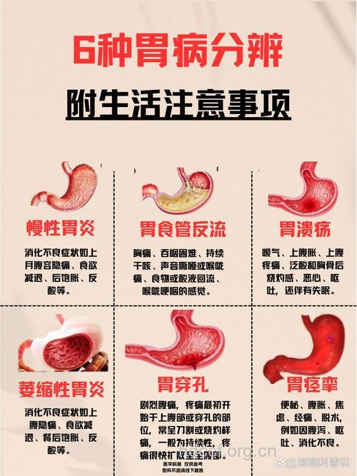 给您的胃特别“胃”藉