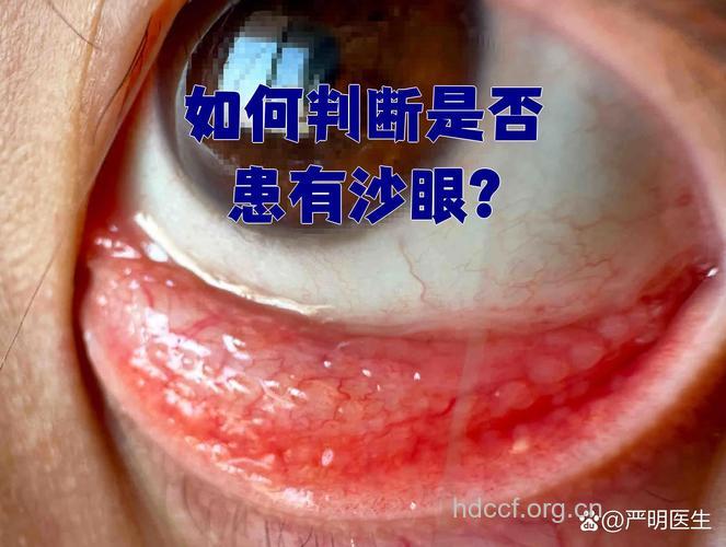 沙眼引起的两大严重后果