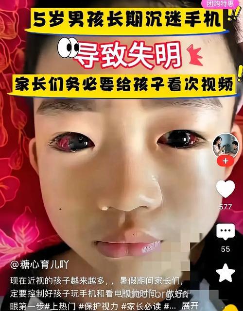 沙眼拖两年 男孩险失明