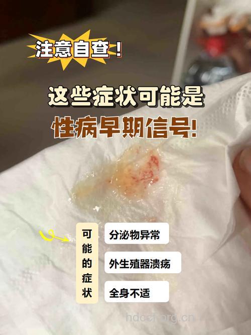 什么人会老怀疑自己得性病