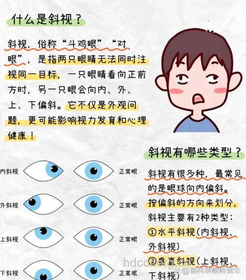 为什么会造成儿童眼睛斜视
