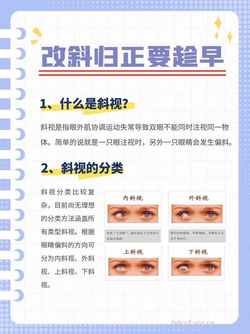 斜视的临床分类