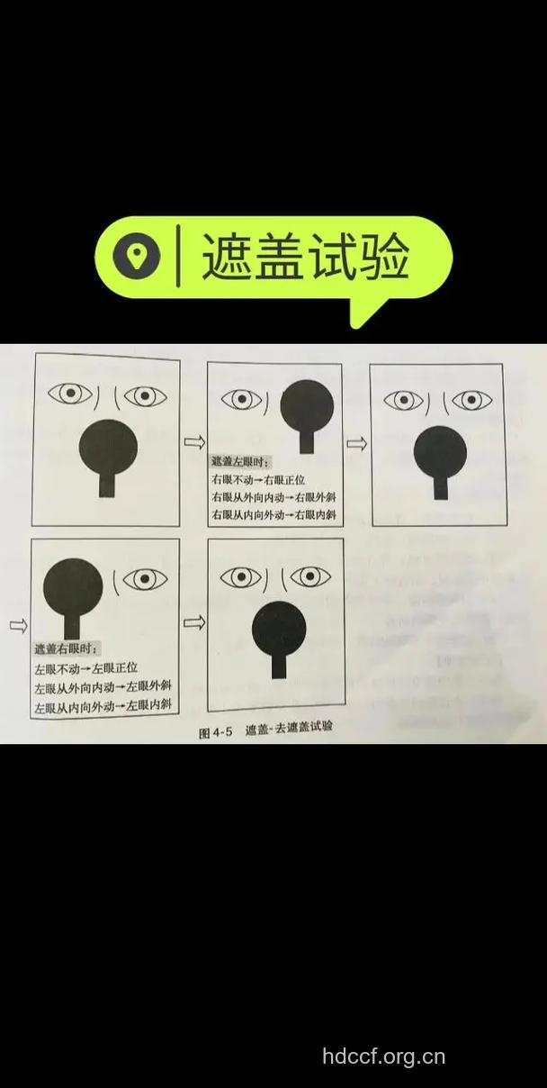 眼位检查法——遮盖法