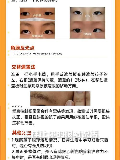 原发性非调节性内斜视的症状与治疗