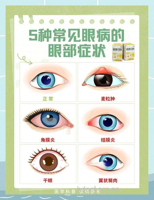 常见的几种眼睑病介绍