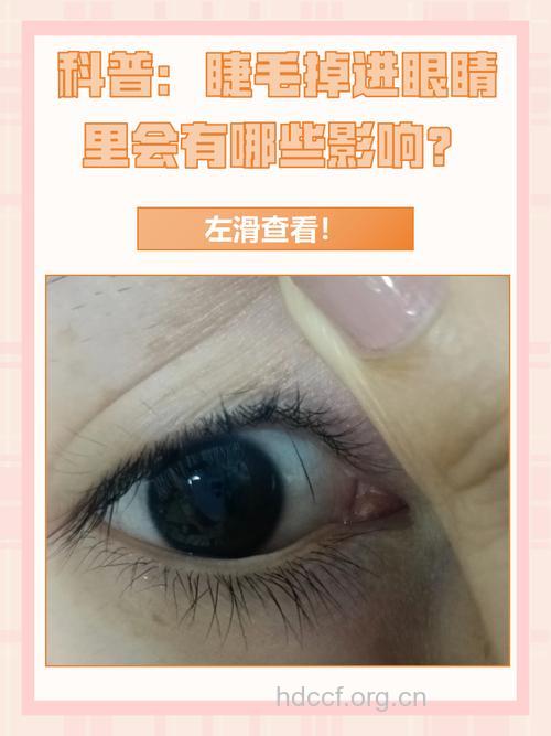睑与睫毛位置异常的表现与治疗