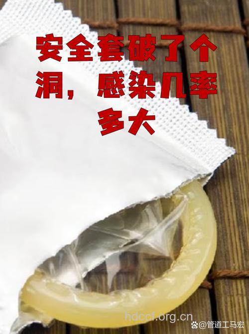 案例:性病恐惧症缘起安全套